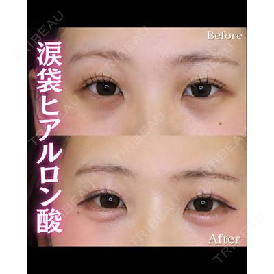KIMI CLINIC 形成・美容外科 志藤 宏計医師の症例
