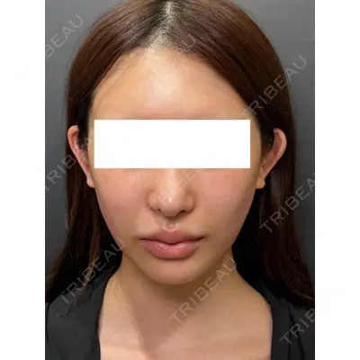 Ledian Clinic六本木の症例