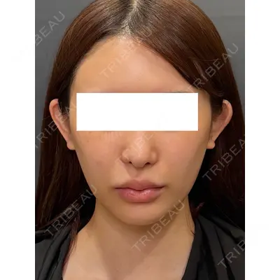 Ledian Clinic六本木の症例