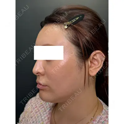Ledian Clinic六本木の症例