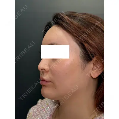 Ledian Clinic六本木の症例