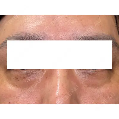 Ledian Clinic六本木の症例