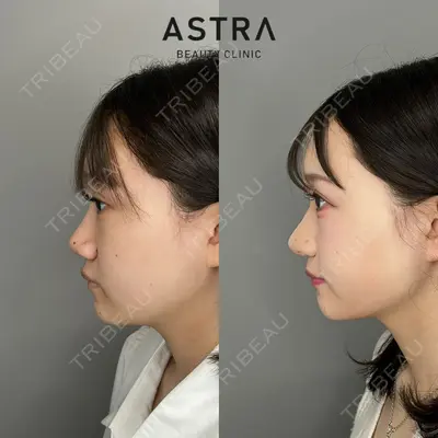 ASTRA BEAUTY CLINIC 塩満 惠子医師の症例