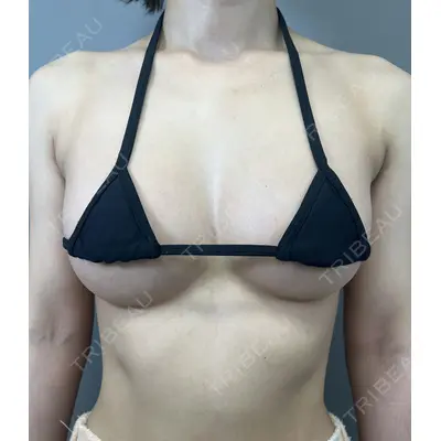 BELINDA CLINIC（ベリンダクリニック）新宿院 井上 真梨子医師の症例