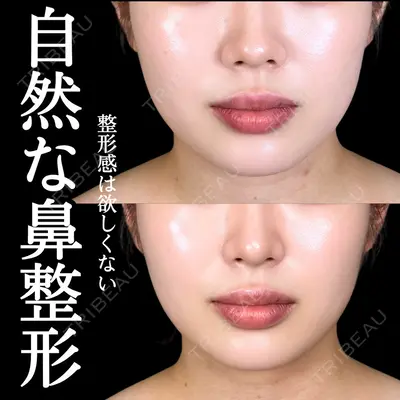 アリエル美容クリニック 大宮院 阪野 一世医師の症例