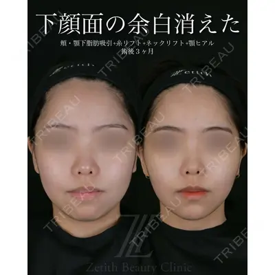 Zetith Beauty Clinic 池袋院 北村 翔医師の症例