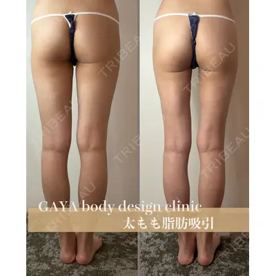 GAYA body design clinicの症例