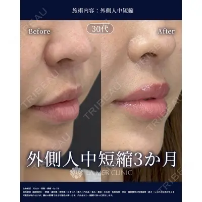 LA MER CLINIC 辻 航平医師の症例
