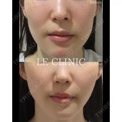 LE CLINICの症例
