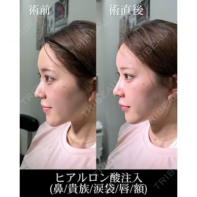 HAAB×DREAM BEAUTY CLINIC 大阪梅田院 錦 実奈医師の症例