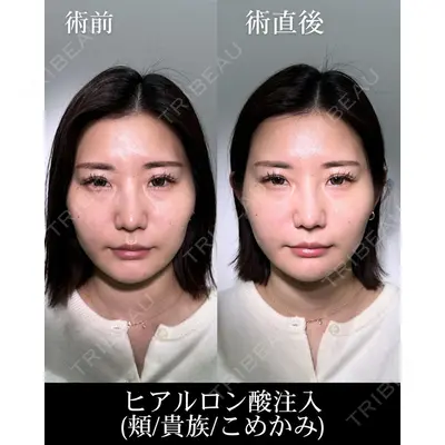 HAAB×DREAM BEAUTY CLINIC 大阪梅田院 錦 実奈医師の症例