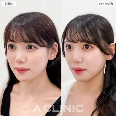 A CLINIC（エークリニック） 銀座院 新妻　克宜医師の症例