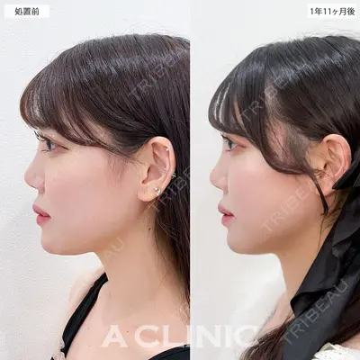 A CLINIC（エークリニック） 銀座院 新妻　克宜医師の症例
