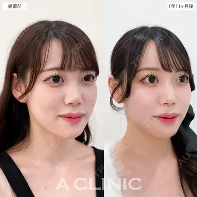 A CLINIC（エークリニック） 銀座院 新妻　克宜医師の症例