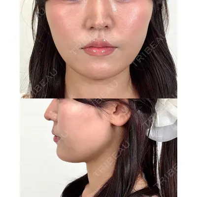 Moon Beauty Clinic 渡邉 正士医師の症例