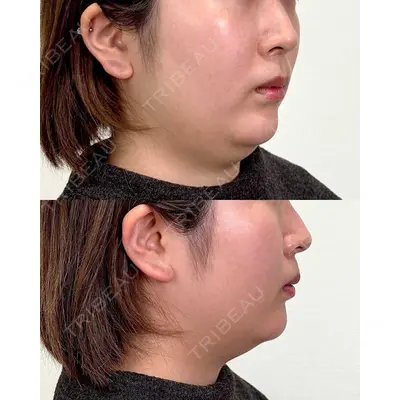 Moon Beauty Clinicの症例