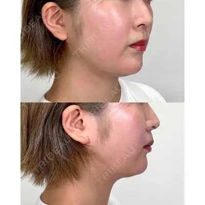 Moon Beauty Clinicの症例