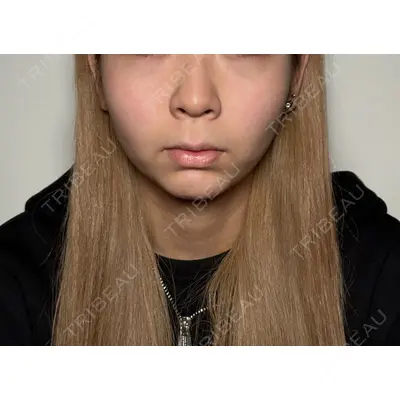 Moon Beauty Clinic 渡邉 正士医師の症例