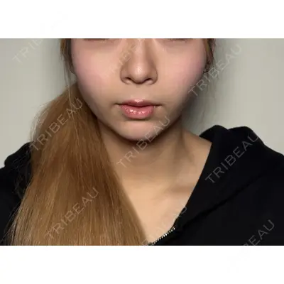 Moon Beauty Clinic 渡邉 正士医師の症例