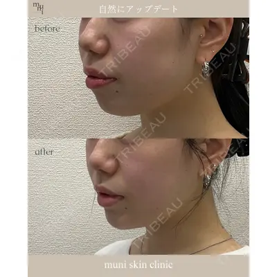 muni skin clinic 高麗 惠理医師の症例