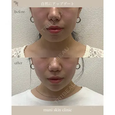 muni skin clinic 高麗 惠理医師の症例