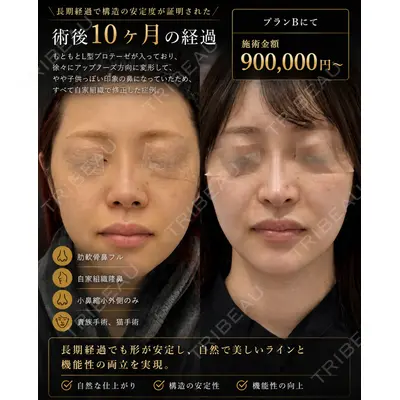 ルラ美容クリニック 渋谷本院 高塚 正己医師の症例