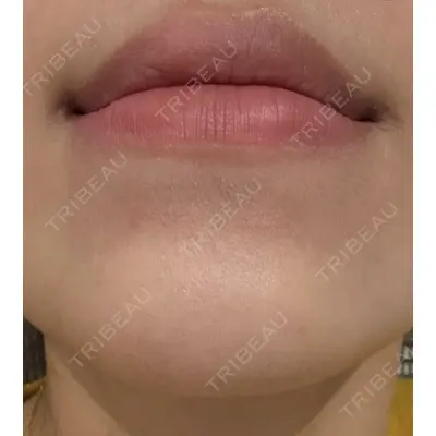 しんゆり美容健康クリニックの症例