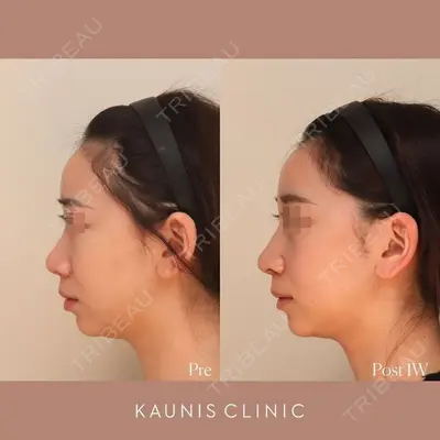 KAUNIS CLINIC（カウニスクリニック）の症例