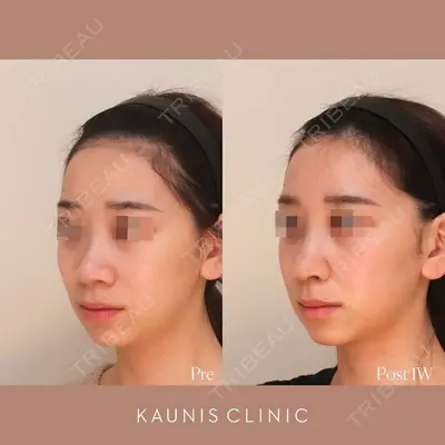 KAUNIS CLINIC（カウニスクリニック）の症例