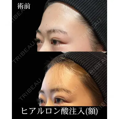 HAAB×DREAM BEAUTY CLINIC 東京本院 佐野 圭医師の症例