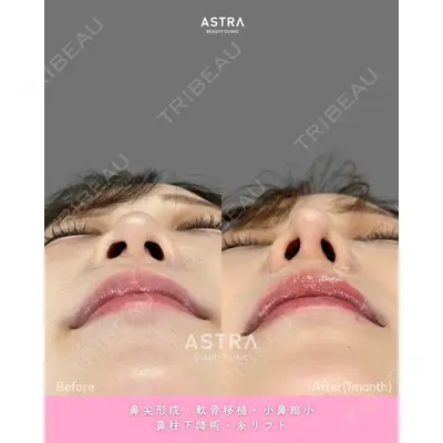 ASTRA BEAUTY CLINIC 河口 はるか医師の症例