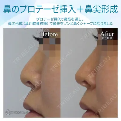 聖心美容クリニック 六本木院 菱田 健作医師の症例