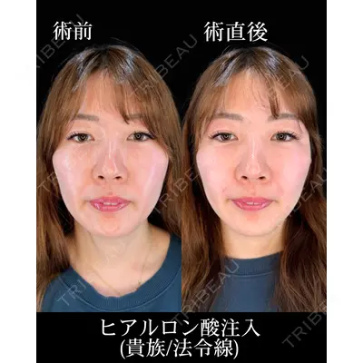 HAAB×DREAM BEAUTY CLINIC 大阪梅田院 鈴木 惇也医師の症例