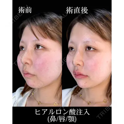 HAAB×DREAM BEAUTY CLINIC 大阪梅田院 鈴木 惇也医師の症例