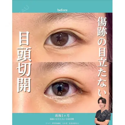 Zetith Beauty Clinic 銀座院 小川 悟史医師の症例