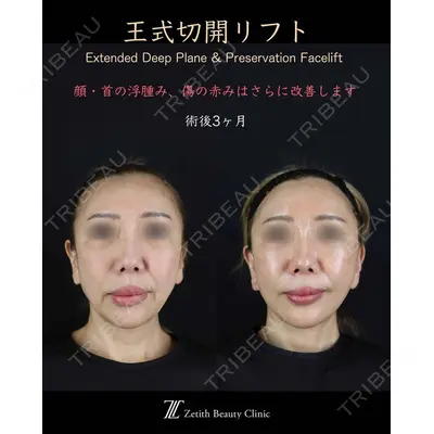 Zetith Beauty Clinic 新宿院 王 蘇医師の症例