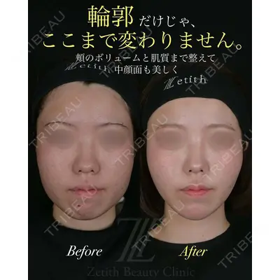 Zetith Beauty Clinic 池袋院 北村 翔医師の症例