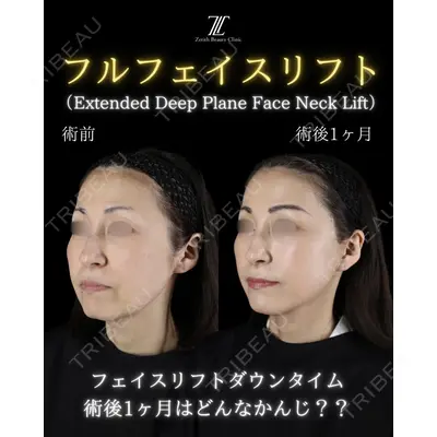 Zetith Beauty Clinic 新宿院の症例