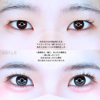 アリエル美容クリニック 水戸院 天白 典秀医師の症例