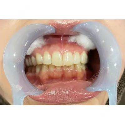 LEAGRANT CLINIC 中目黒 沼﨑 まい医師の症例