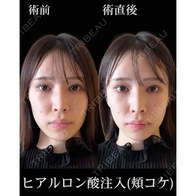 HAAB×DREAM BEAUTY CLINIC 東京本院 佐野 圭医師の症例