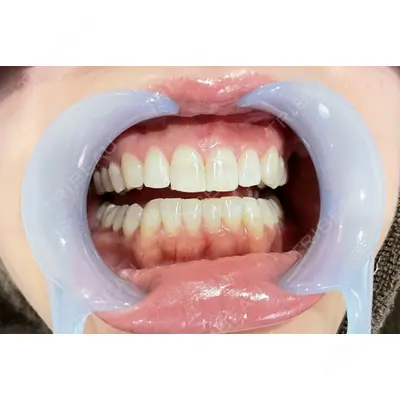 LEAGRANT CLINIC 中目黒 沼﨑 まい医師の症例