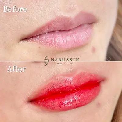 NARU Beauty Clinic 【ナルクリ】の症例