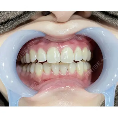 LEAGRANT CLINIC 中目黒 沼﨑 まい医師の症例