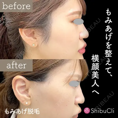 渋谷美容外科クリニック 新橋院の症例