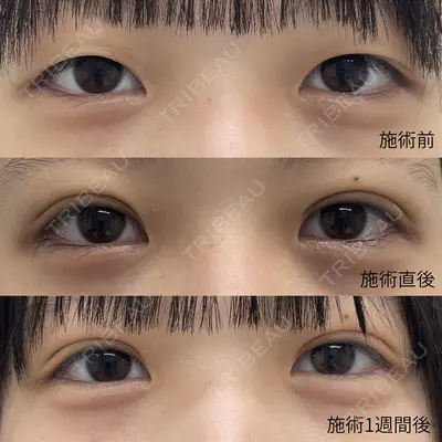おおたかの森ビューティークリニックthe artの症例