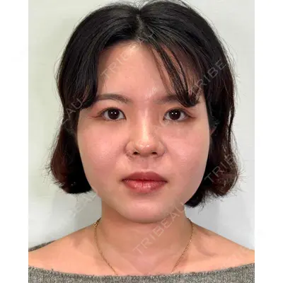 Moon Beauty Clinic 渡邉 正士医師の症例