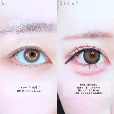 アリエル美容クリニック 水戸院 天白 典秀医師の症例