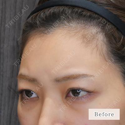 CLEAN BEAUTY CLINIC TokyoAzabu 三田 亜耶医師の症例