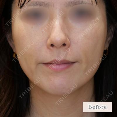 CLEAN BEAUTY CLINIC TokyoAzabu 三田 亜耶医師の症例